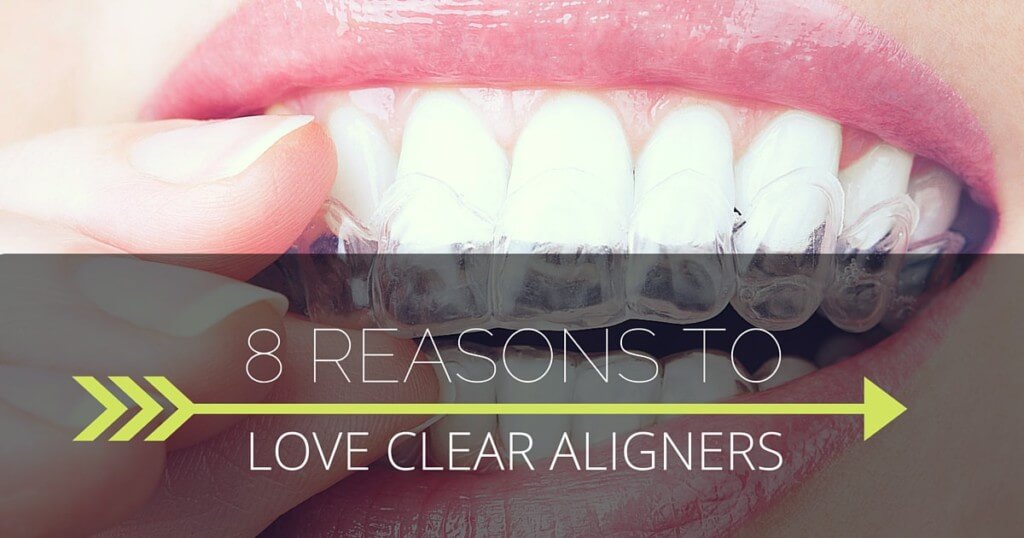 clear aligners