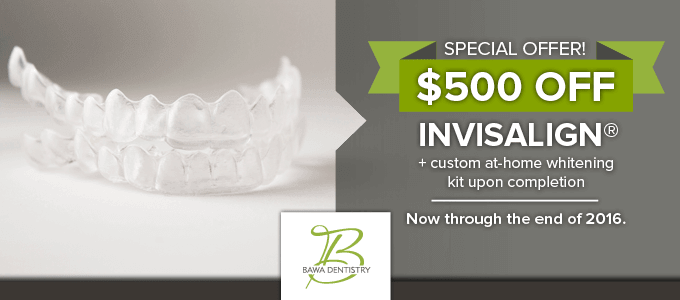 Get $500 off Invisalign at Bawa Dental until the end of 2016