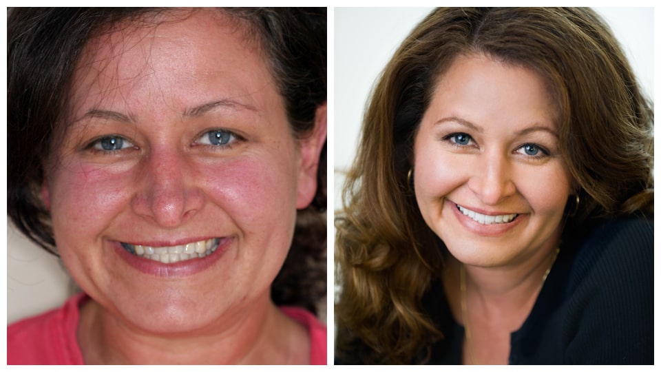 A photo collage featuring two images of a smiling woman, captured before and after a transformative smile design at Bawa Dentistry